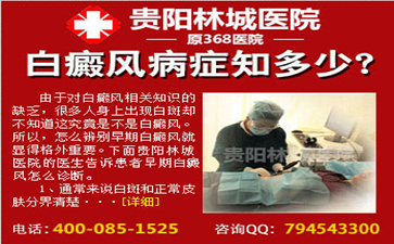 白癜风会对患者造成什么样的危害