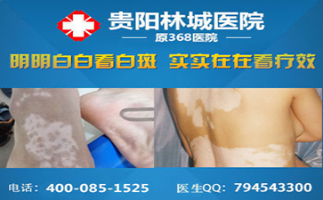 白癜风患者要如何来放松心情